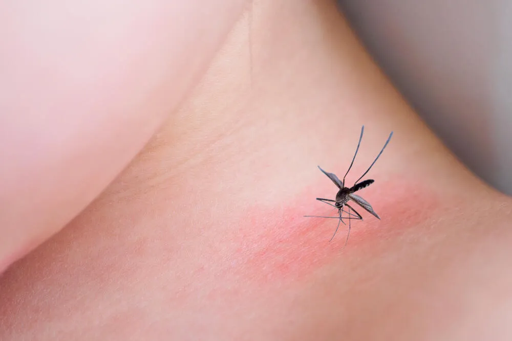 Infestação de mosquitos pretos: o que fazer? Infestação de mosquitos pretos: o que fazer?