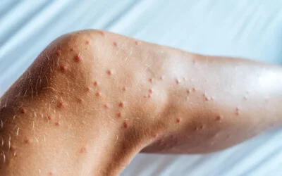 Tipos de mosquitos domésticos: conheça quais são eles